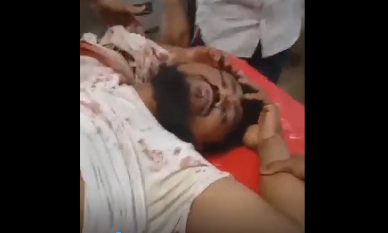 চকলেট আর চিপস কিনতে গেলে নোয়াখালীতে সন্ত্রাসীদের গুলিতে শিশু নিহত, গুলিবিদ্ধ বাবা