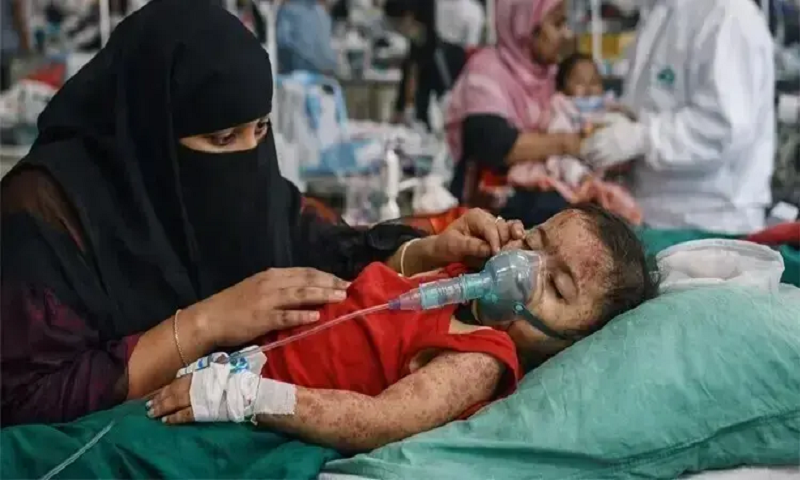 এক মাসে হাম ও হামের উপসর্গ নিয়ে মৃত্যু ১৯৮ 